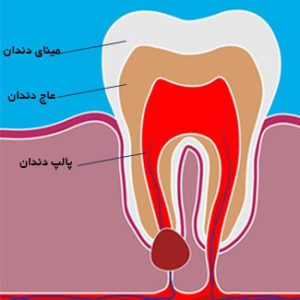 دندان از چه بخش هایی تشکیل شده
