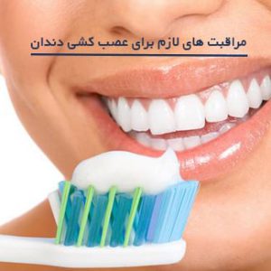 بعد از عصب کشی دندان چه مراقبتی لازم است